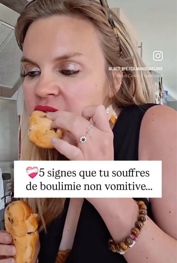 boulimie non vomitive